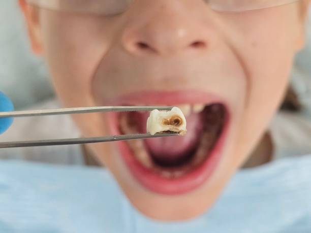 Best Emergency Dental Surgery in Leesburg, VA