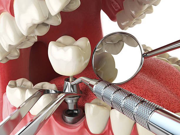 Reliable VA Emergency Dentist Solutions